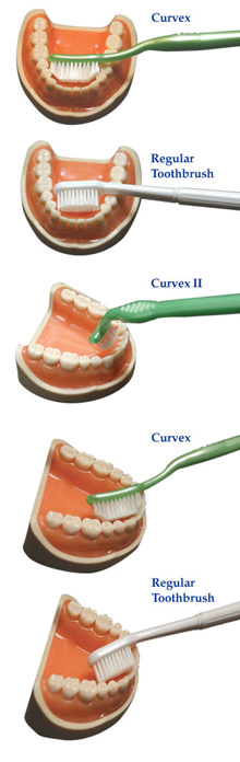 CURVEX 2